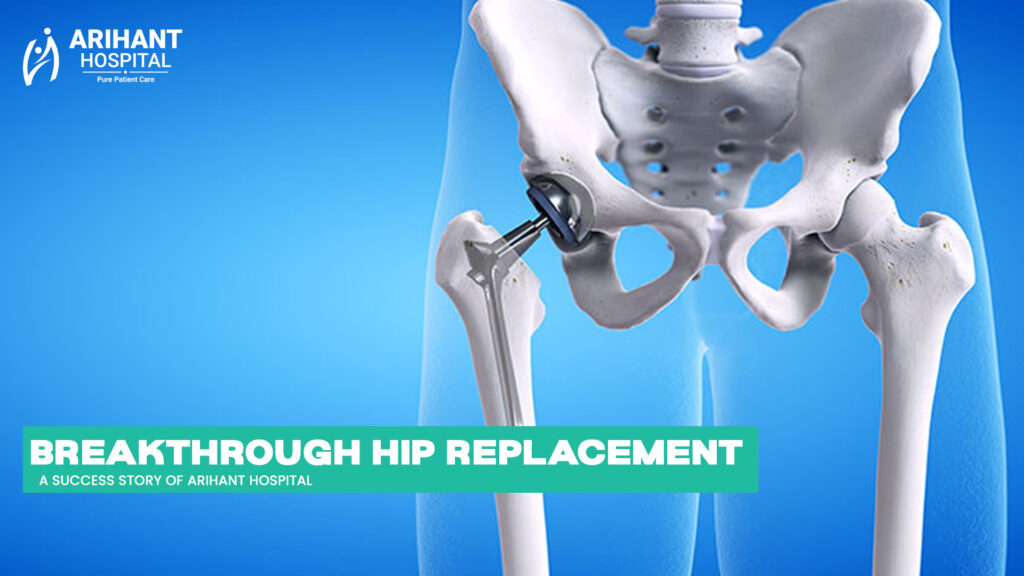 Hip Replacement in Dehradun