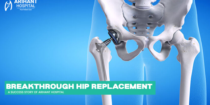 Hip Replacement in Dehradun