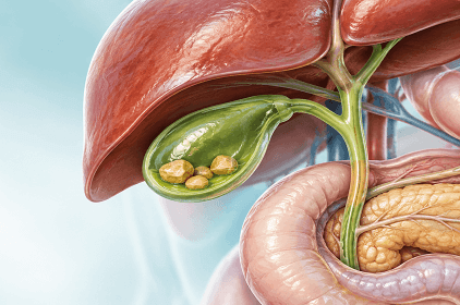 Gallbladder Stones at Arihant Hospitals