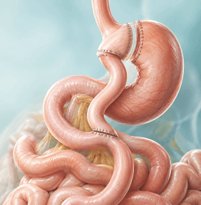 Advanced Operation Theatre and Bariatric Suite at Arihant Hospital