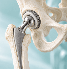 Advanced orthopaedic joint surgery suite at Arihant Hospital Dehradun